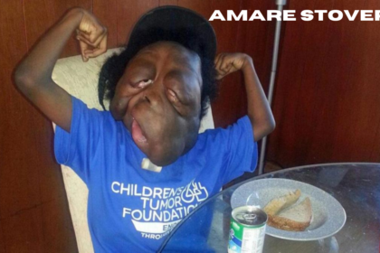 amare stover